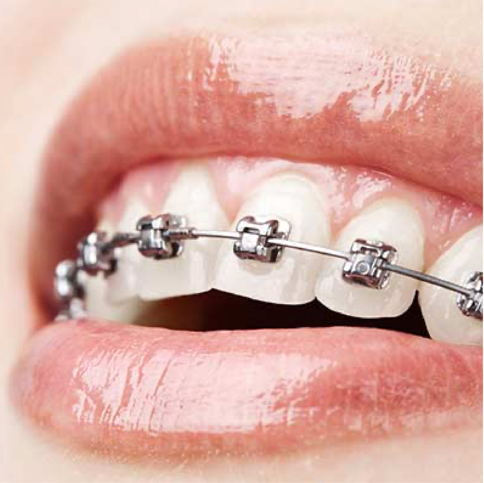 imgi_50_ortodoncia-2-2048x2044